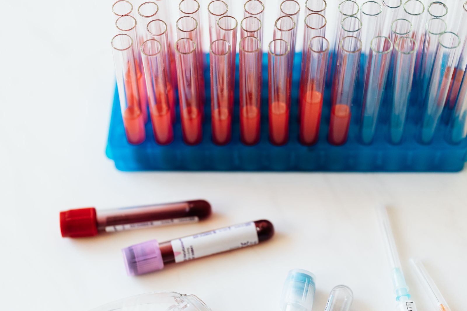 Top-down view of labelled blood-sample vials and a test tube on a clean white surface.